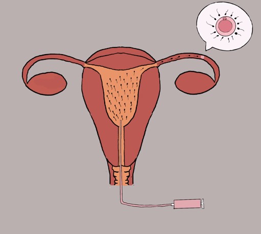 鈞安婦幼聯合醫院的試管嬰兒中心圖片